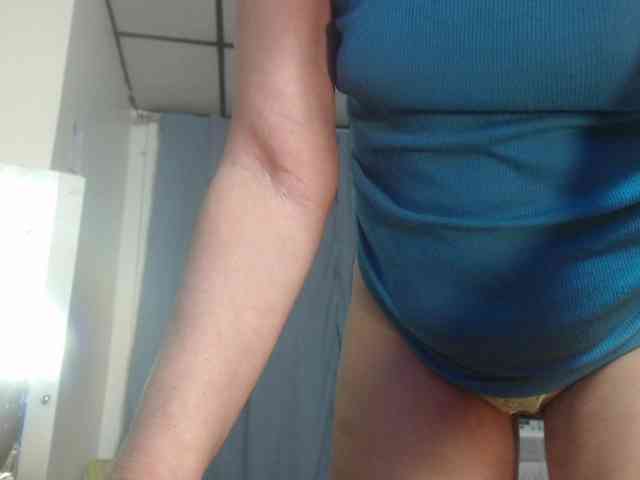 Modelo: FIXMYASSTOO