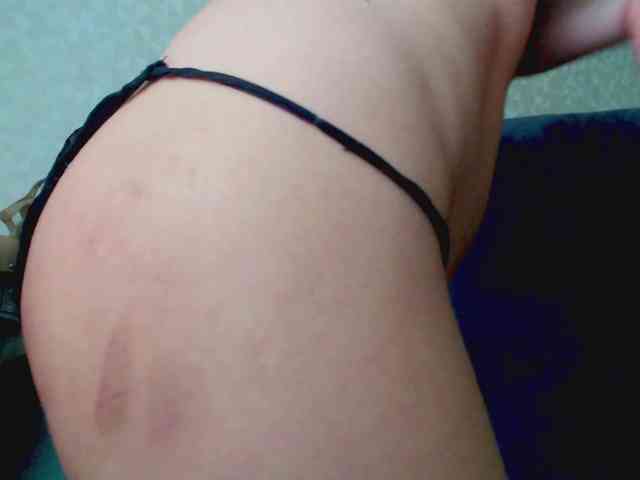 Missforkisss webcam