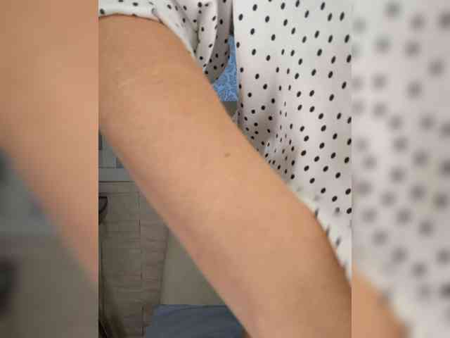 Anesteishen