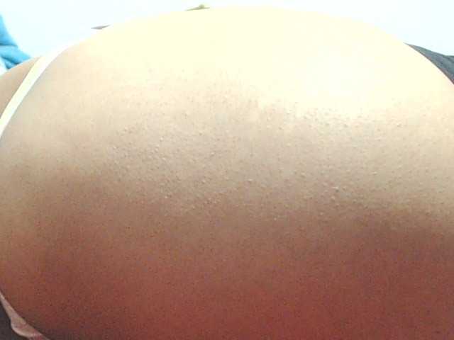 HOTTTSKIN