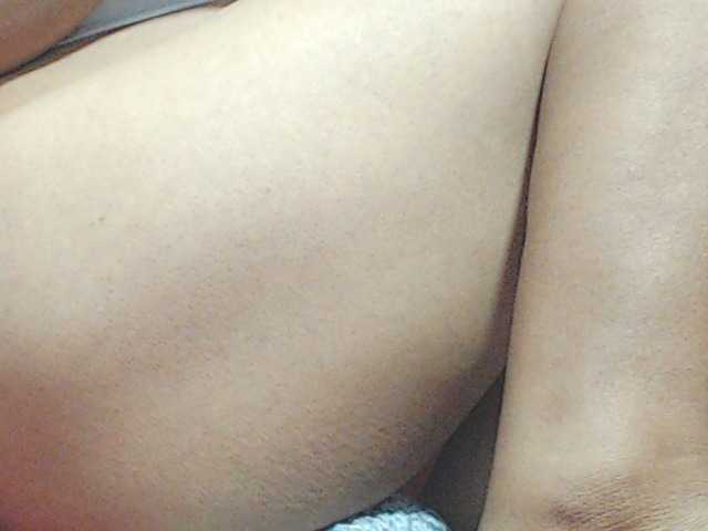 HOTTTSKIN