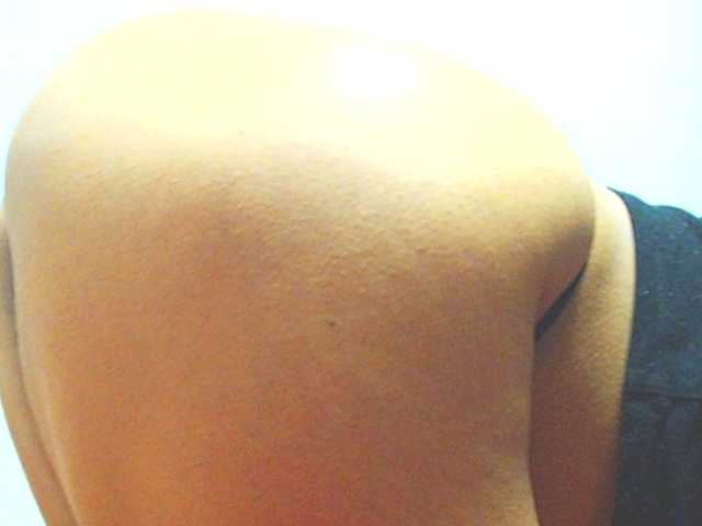 HOTTTSKIN