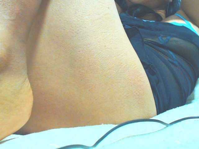 HOTTTSKIN