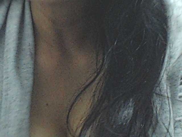 HOTTTSKIN