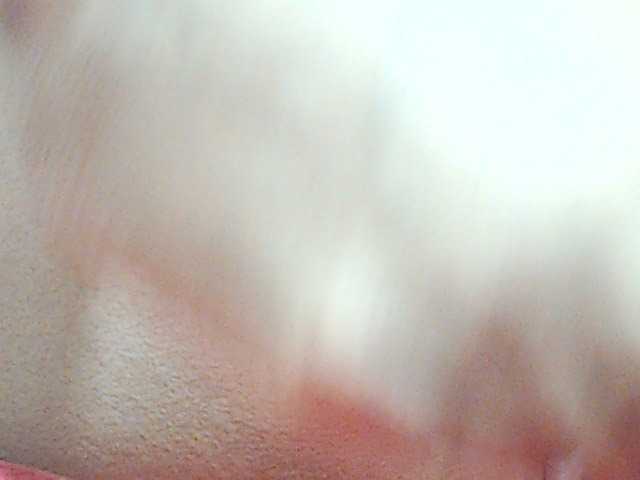 HOTTTSKIN