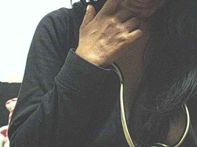 HOTTTSKIN