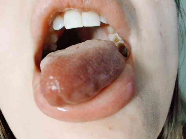 hotmiamix webcam