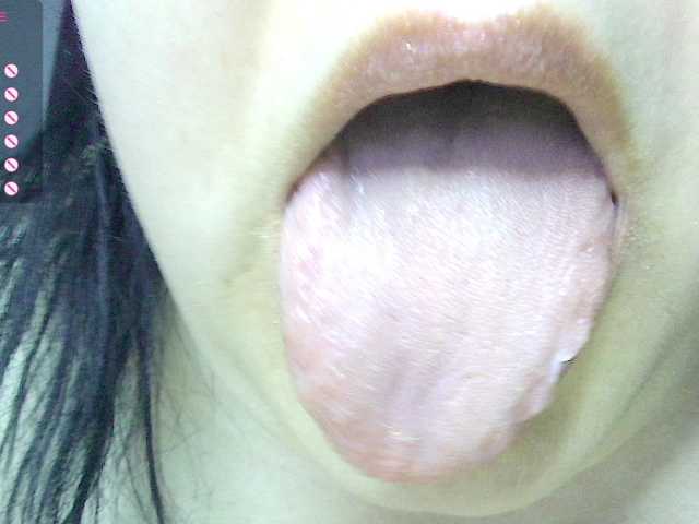 -WINNI-