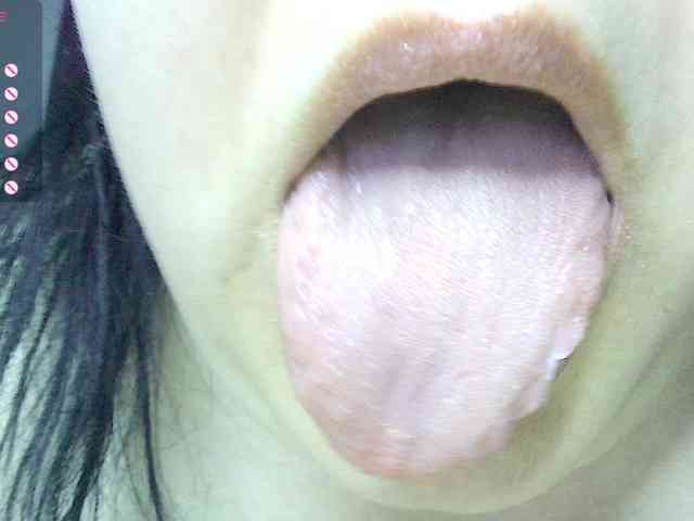 -WINNI-PUX- -WINNI-PUX-
