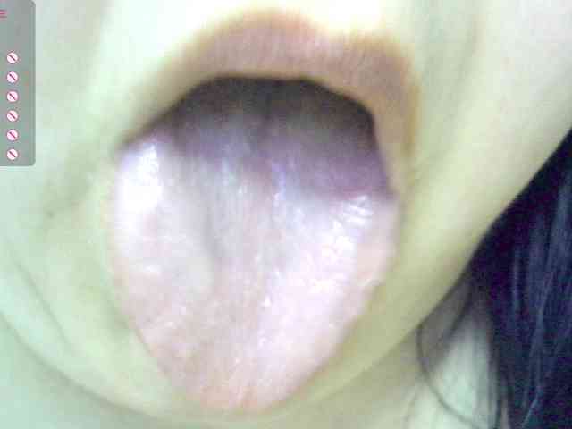 -WINNI-PUX- webcam