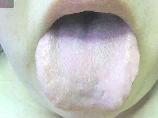 -WINNI-PUX-