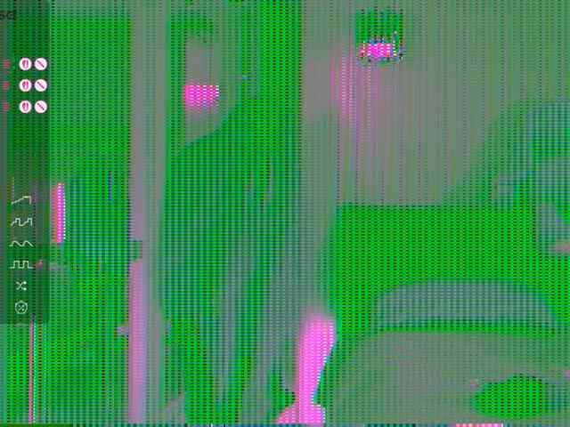 Anesthesiia webcam