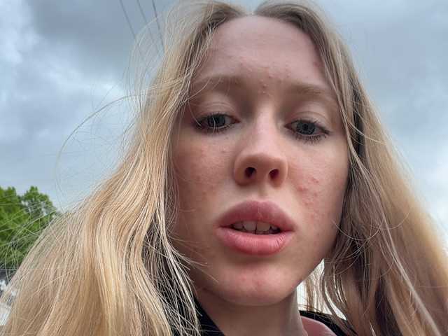 Likachkaa
