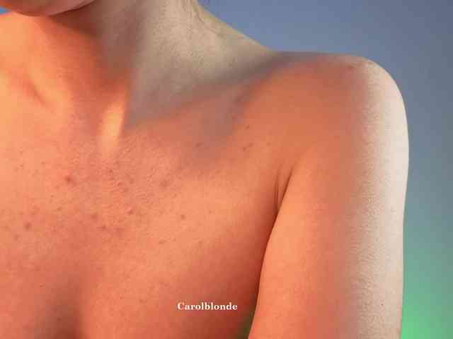 Carolblonde