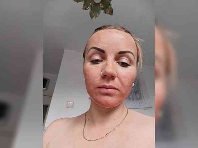 -NeZabudka