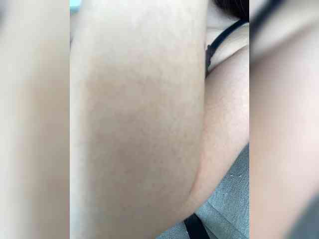 FurElisse FurElisse