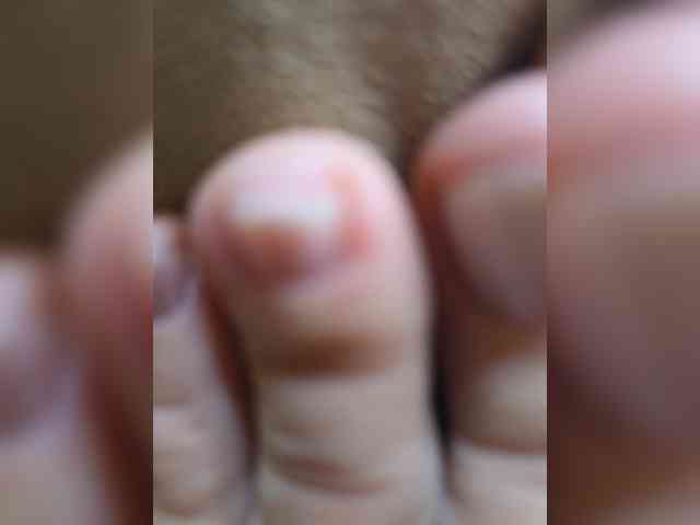 HairyCrotch HairyCrotch