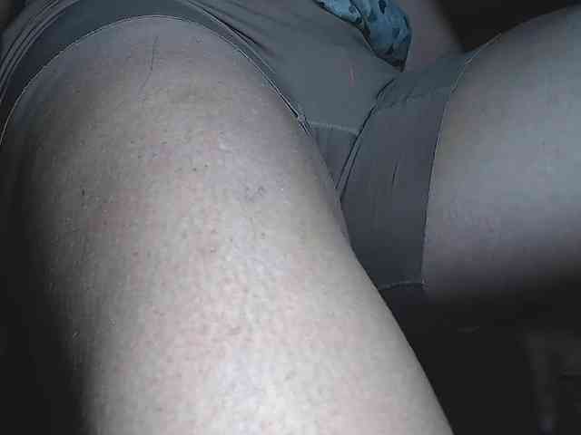 candylovet