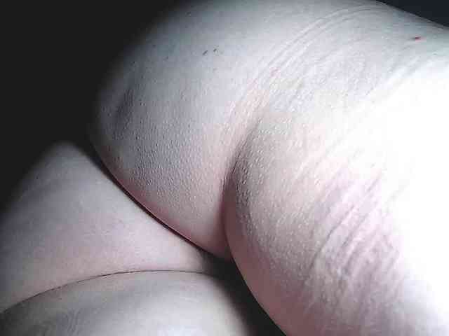 candylovet
