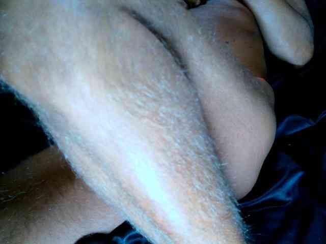 analpassion