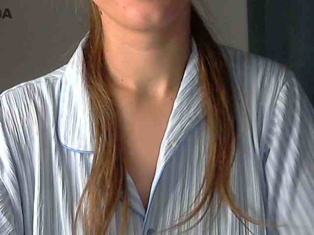Modella: Lolakisss