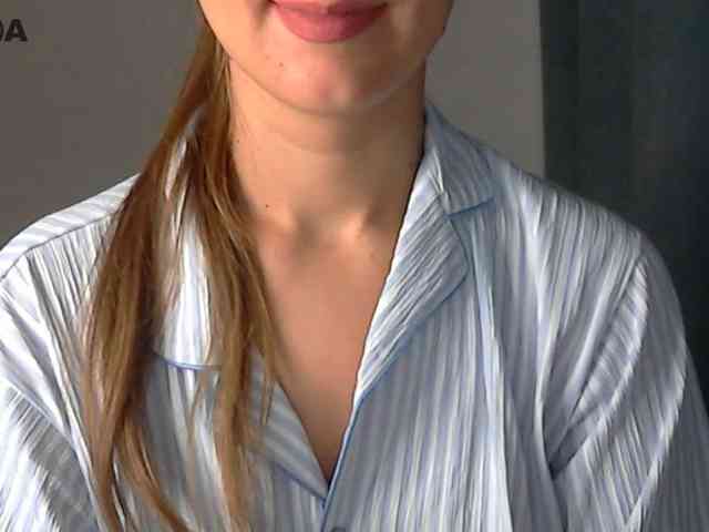 Modelo: Lolakisss