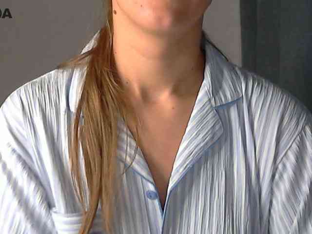 Modelo: Lolakisss