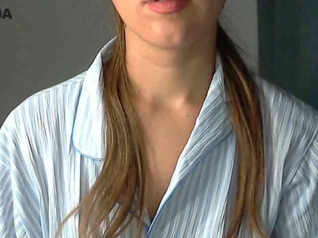 Model: Lolakisss