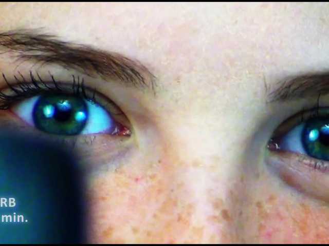 DiaFoxi preview