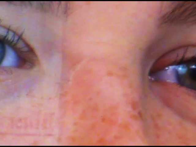 DiaFoxi