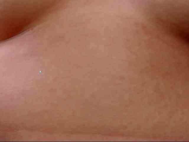 DiaFoxi
