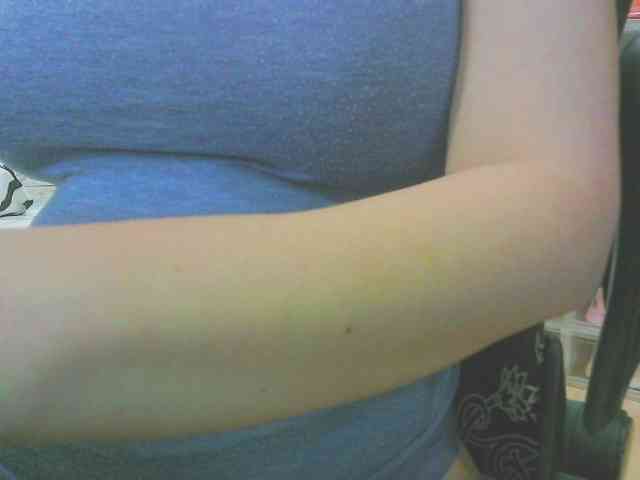 KeepmepregO