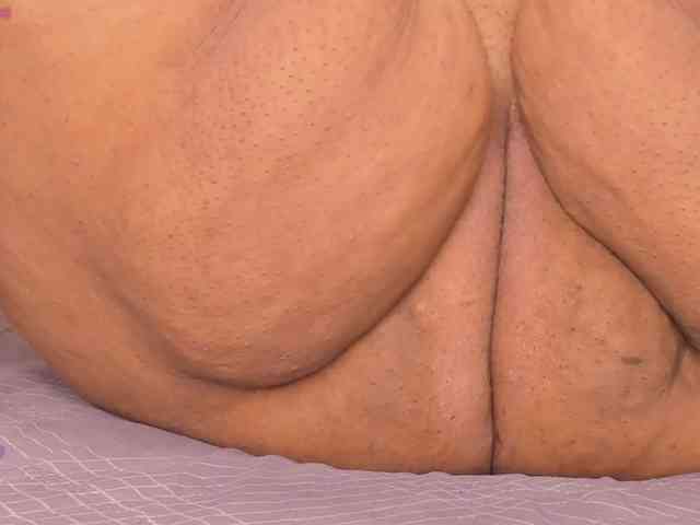 Kimiekaboom