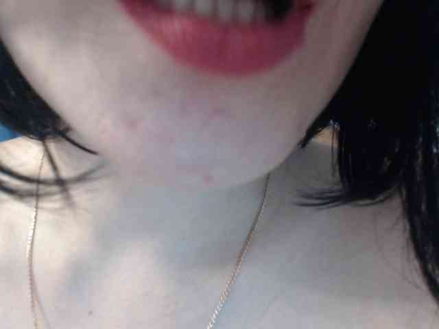 Model: MyP_MyP