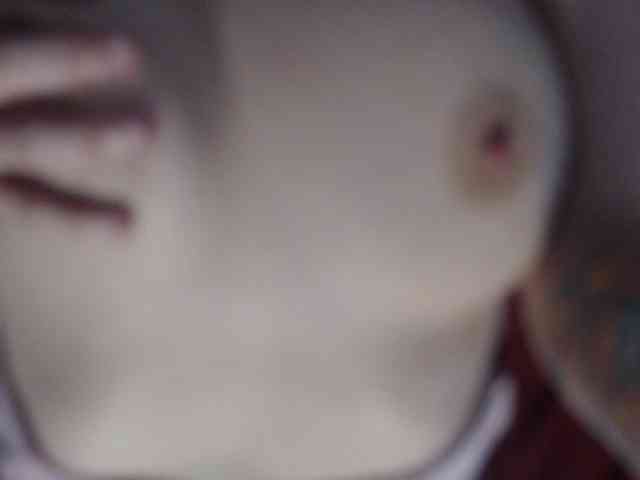 Model: MyP_MyP