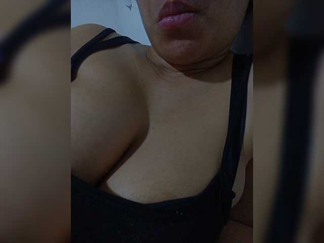 Dolceskin2