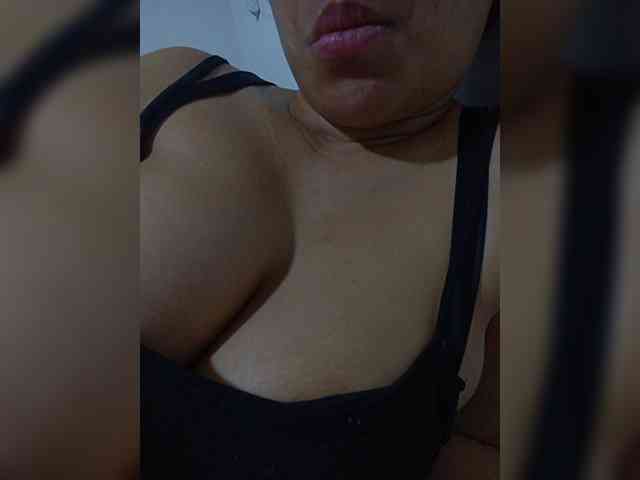 Dolceskin2