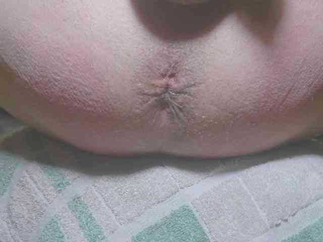 annitsx