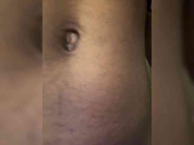 anayys