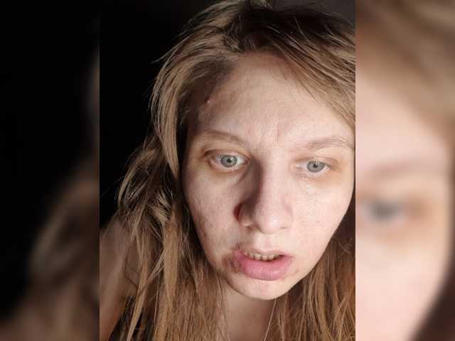 LinNatty
