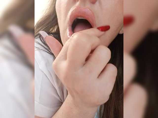 miss-kiss-kiss online