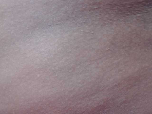 RACHELL-HOT