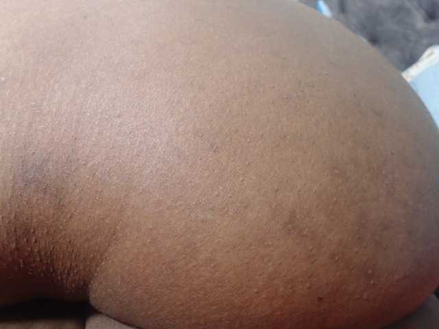 RACHELL-HOT live cam preview