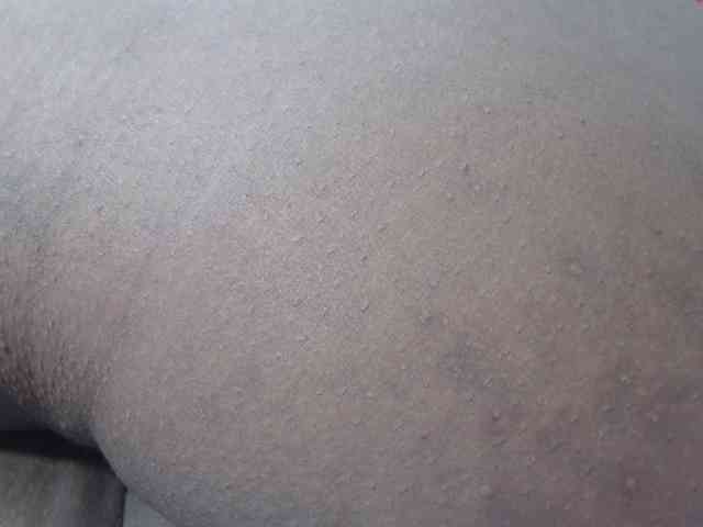 RACHELL-HOT webcam
