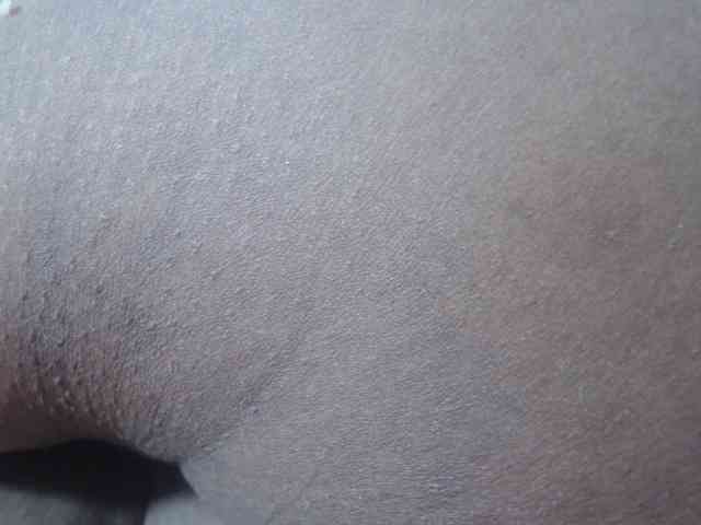 RACHELL-HOT webcam