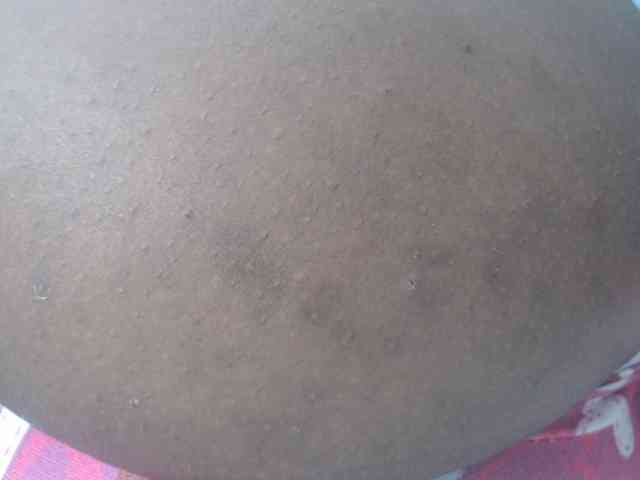 RACHELL-HOT