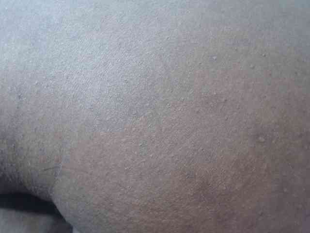RACHELL-HOT