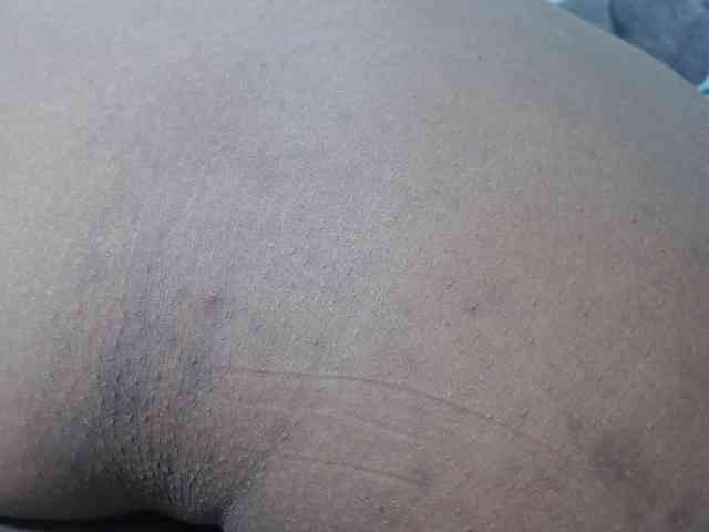 RACHELL-HOT webcam