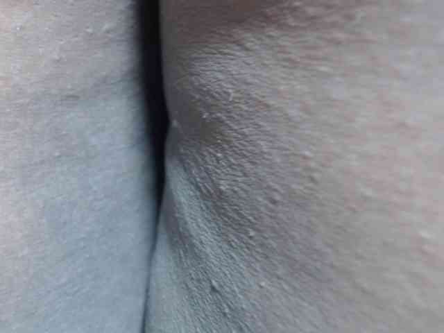 RACHELL-HOT RACHELL-HOT