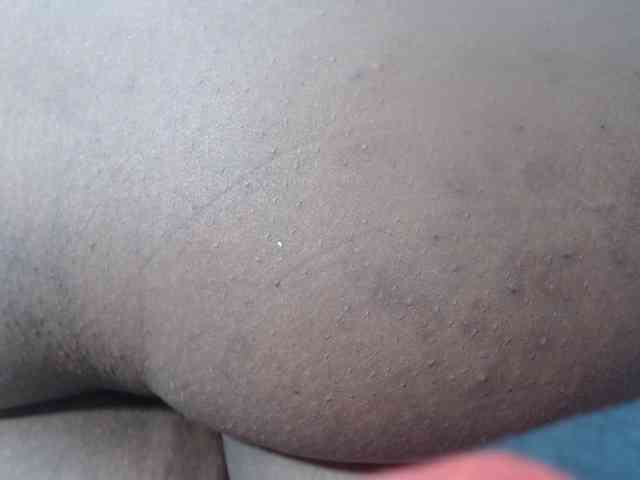 Modelo: RACHELL-HOT
